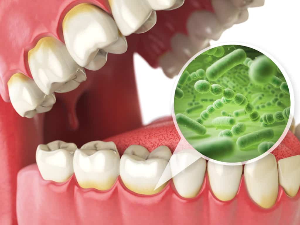 dry mouth causes remedies