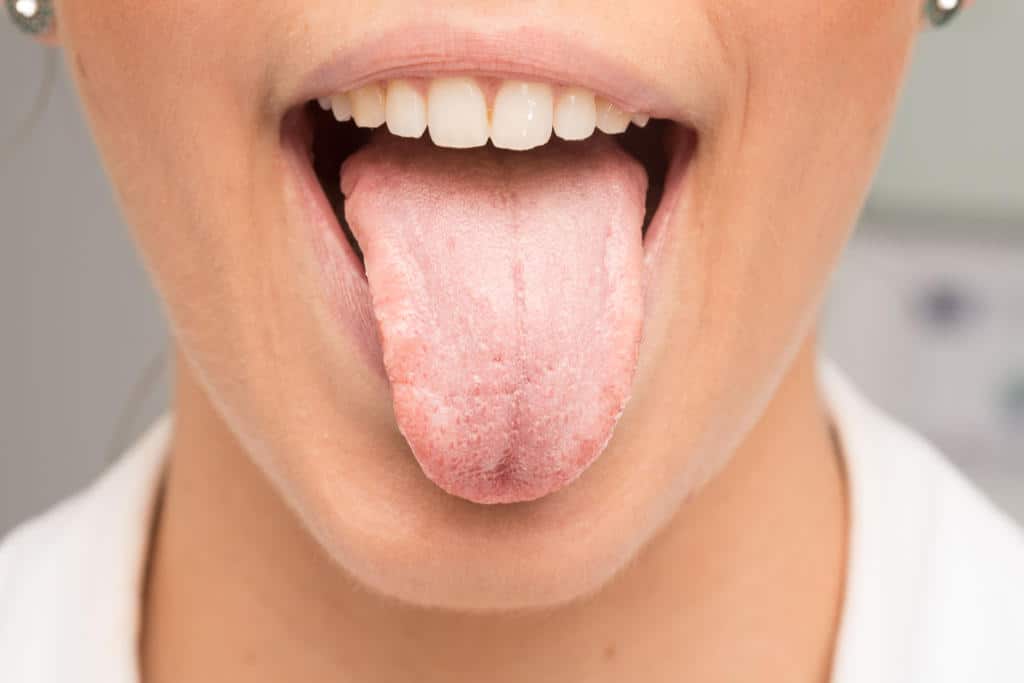cause dry mouth